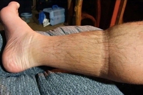 Симптомы инфаркта, которые должен знать каждый! Во время инфаркта человек испытывает резкий приступ боли,…